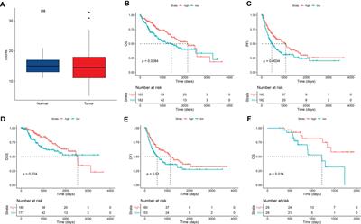 Tumor cuproptosis and immune infiltration improve survival of patients with hepatocellular carcinoma with a high expression of ferredoxin 1